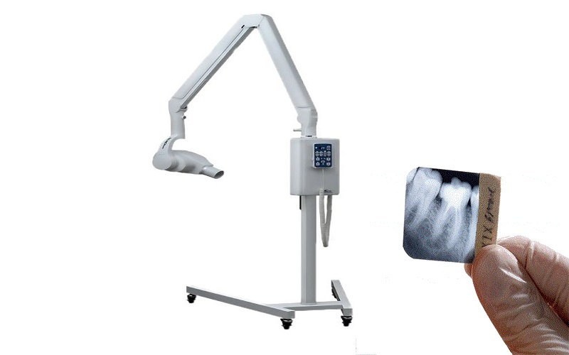 رادیوگرافی تک دندان چیست